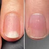Resultum Onistopix Oil – Aceite regenerador para uñas y piel