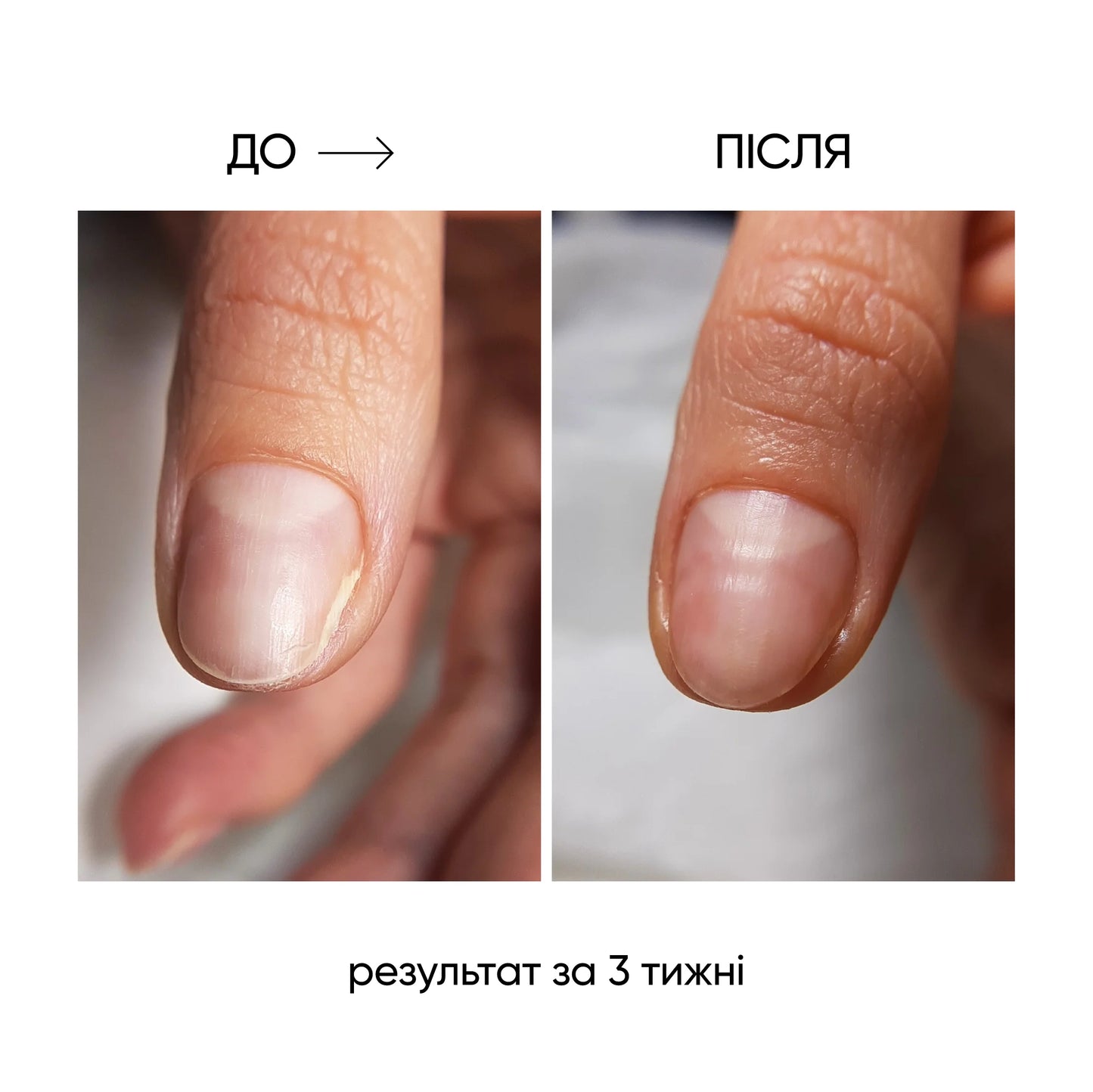 NAILSOFTHEDAY ONISTOP - Aceite Nutritivo para Cutículas y Uñas, 15 ml