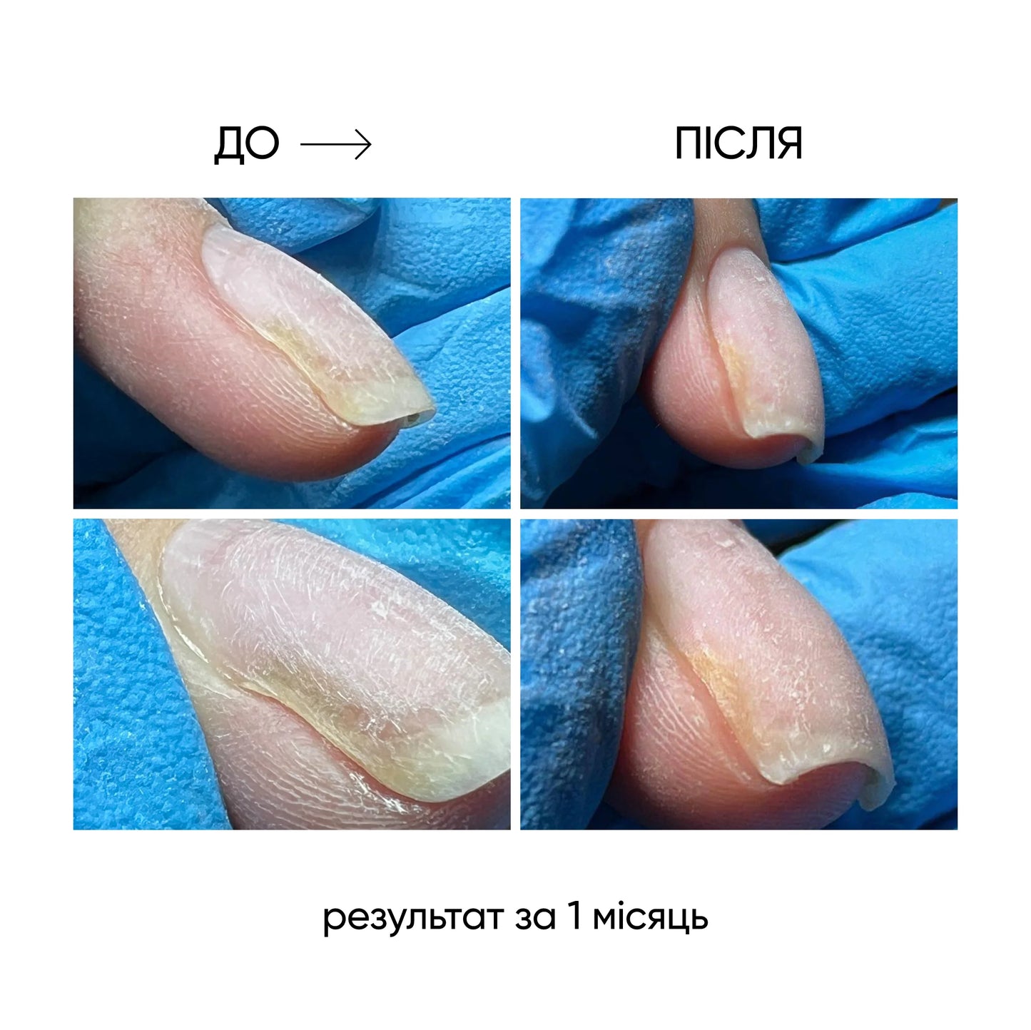 NAILSOFTHEDAY ONISTOP - Aceite Nutritivo para Cutículas y Uñas, 15 ml