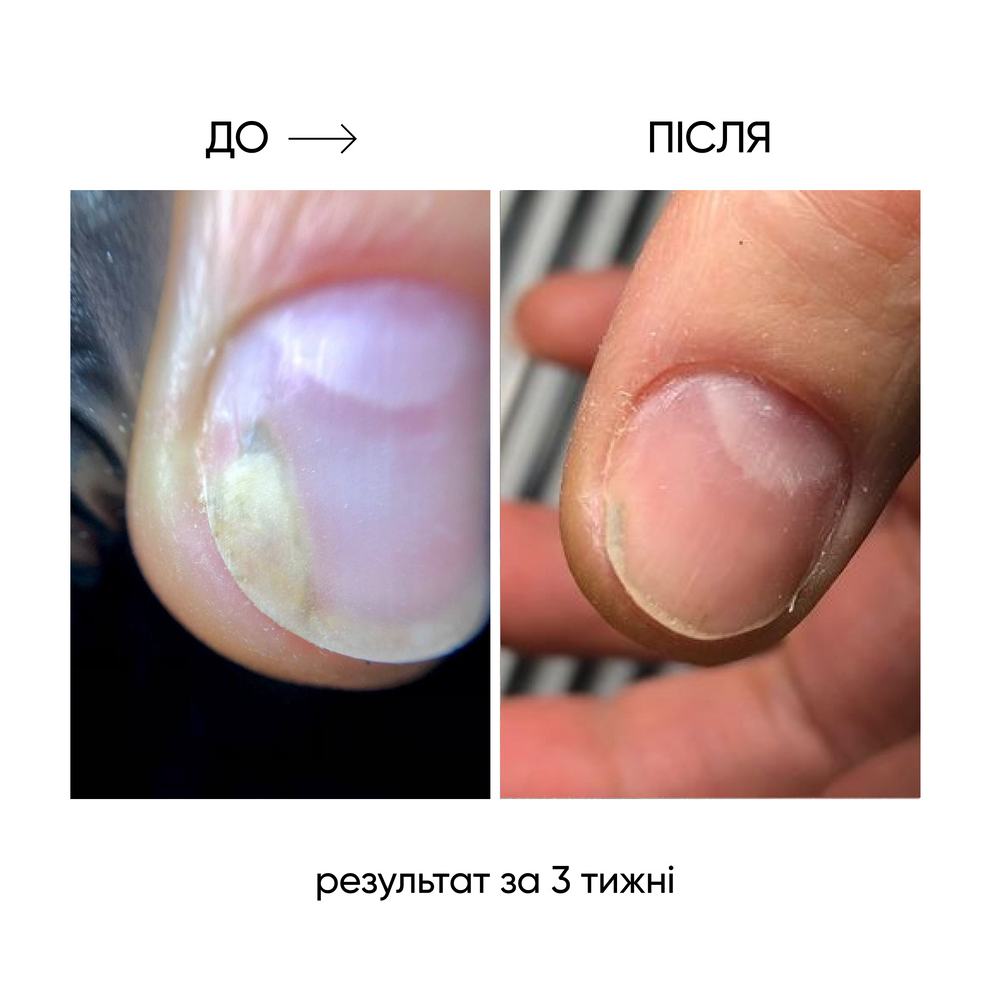 NAILSOFTHEDAY ONISTOP – Aceite regenerador, 8 ml