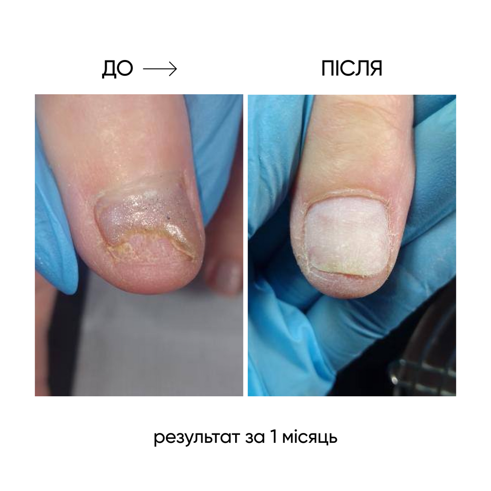 NAILSOFTHEDAY ONISTOP – Aceite regenerador, 8 ml