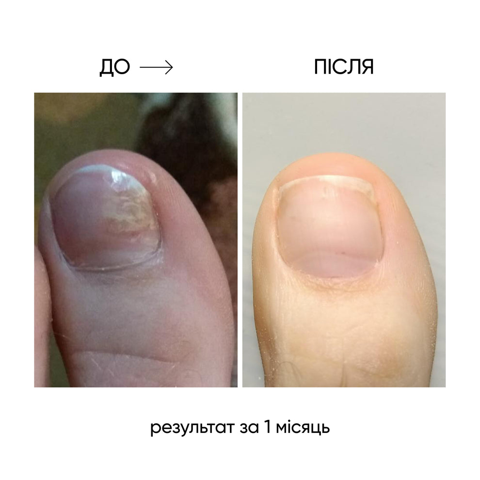 NAILSOFTHEDAY ONISTOP – Aceite regenerador, 8 ml